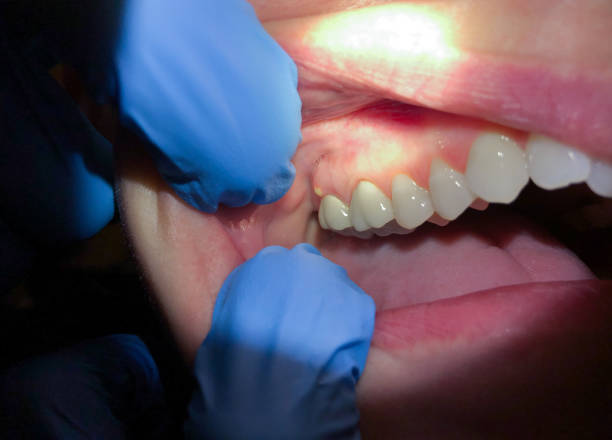 Best Orthodontic Emergency Dentist in Trumansburg, NY