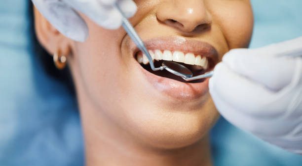 Best Emergency Dental Extractions in Trumansburg, NY