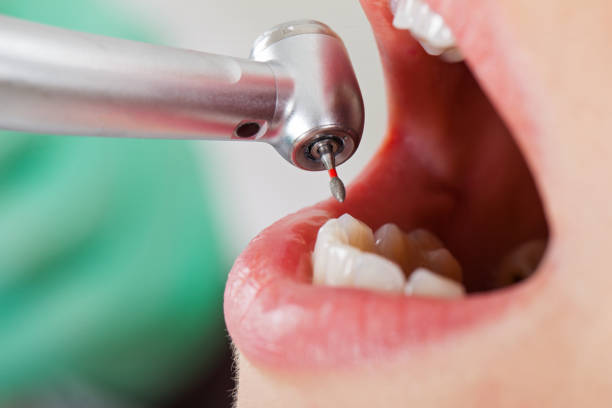 Best Urgent Dental Care for Toothache in Trumansburg, NY